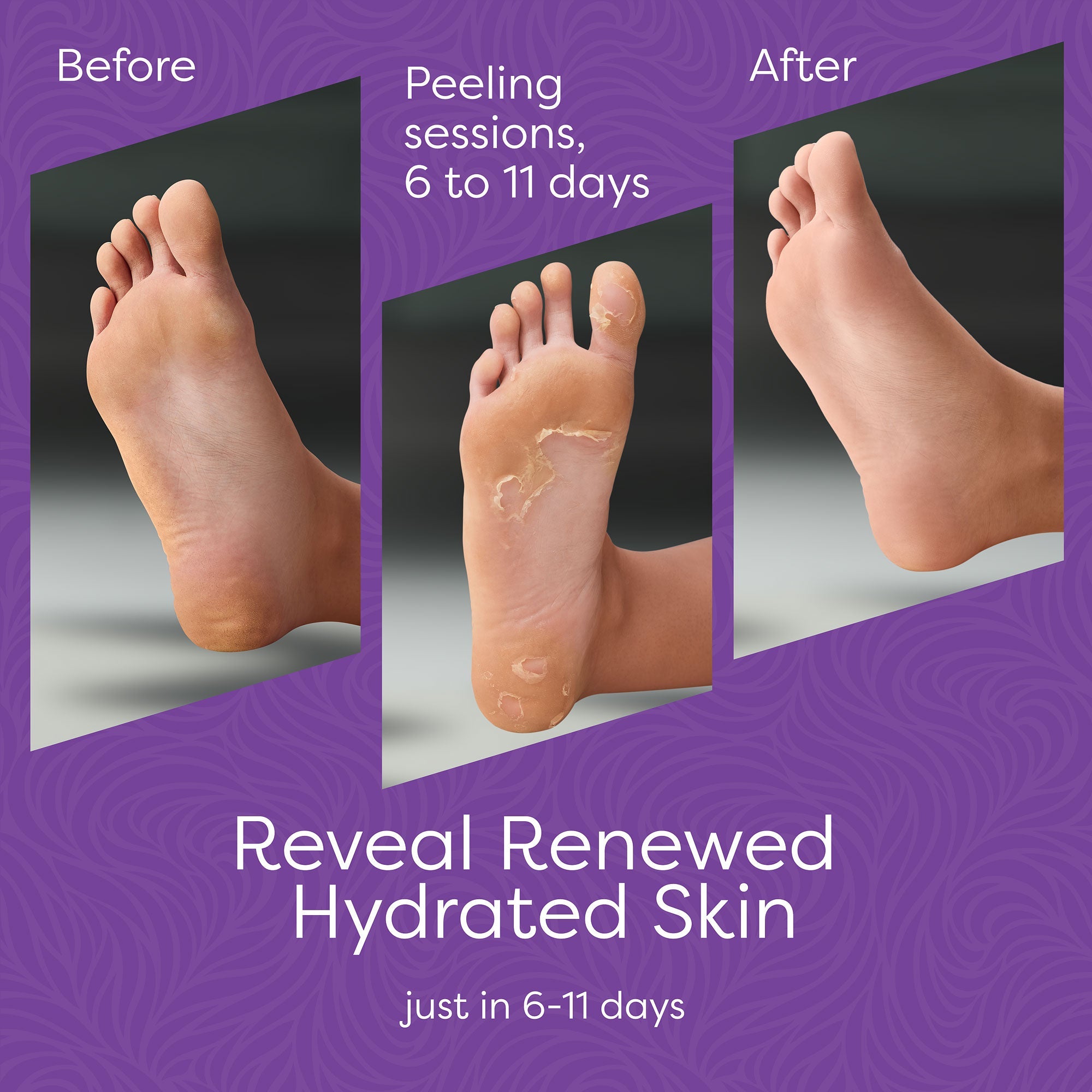 Aesta Foot Peel Mask, 3 - in - 1 - The Recovery Outlet
