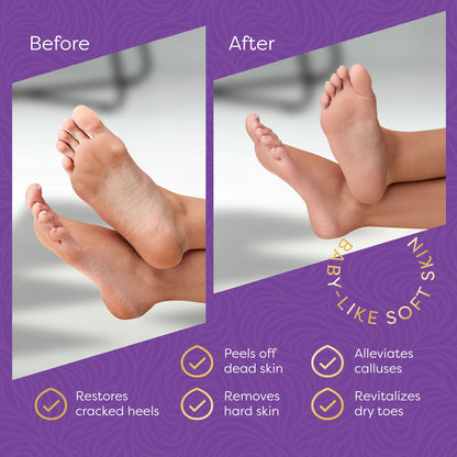 Aesta Foot Peel Mask, 3 - in - 1 - The Recovery Outlet